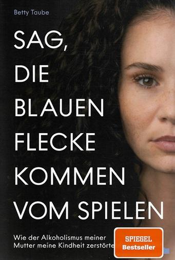 Taube, Sag, die blauen Flecke kommen vom Spielen.